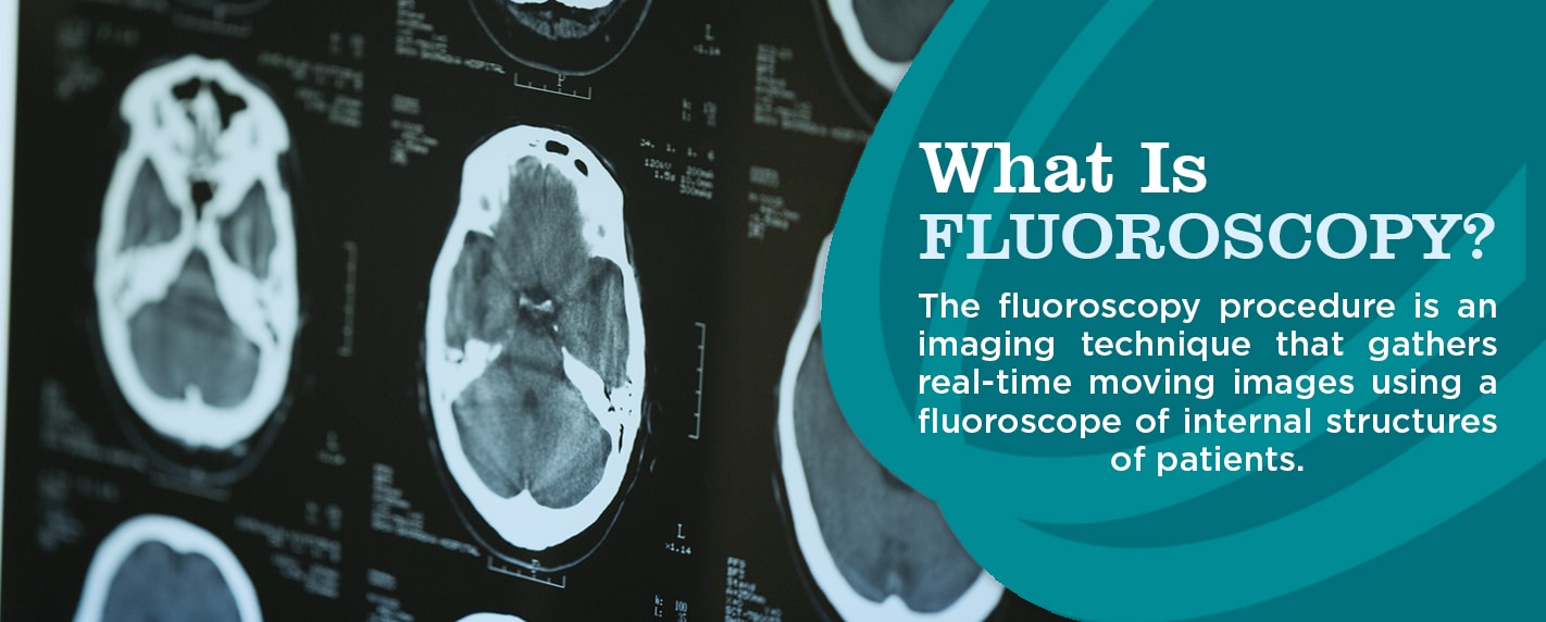 What is fluoroscopy