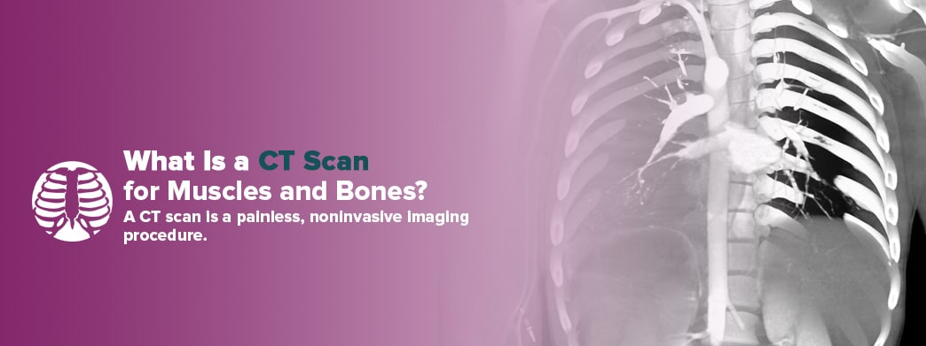 What is a CT scan for muscles and bones