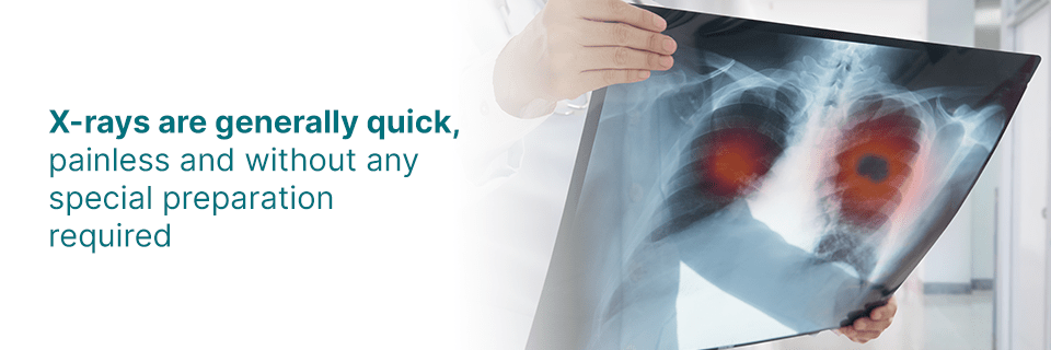 X-rays are generally quick and painless