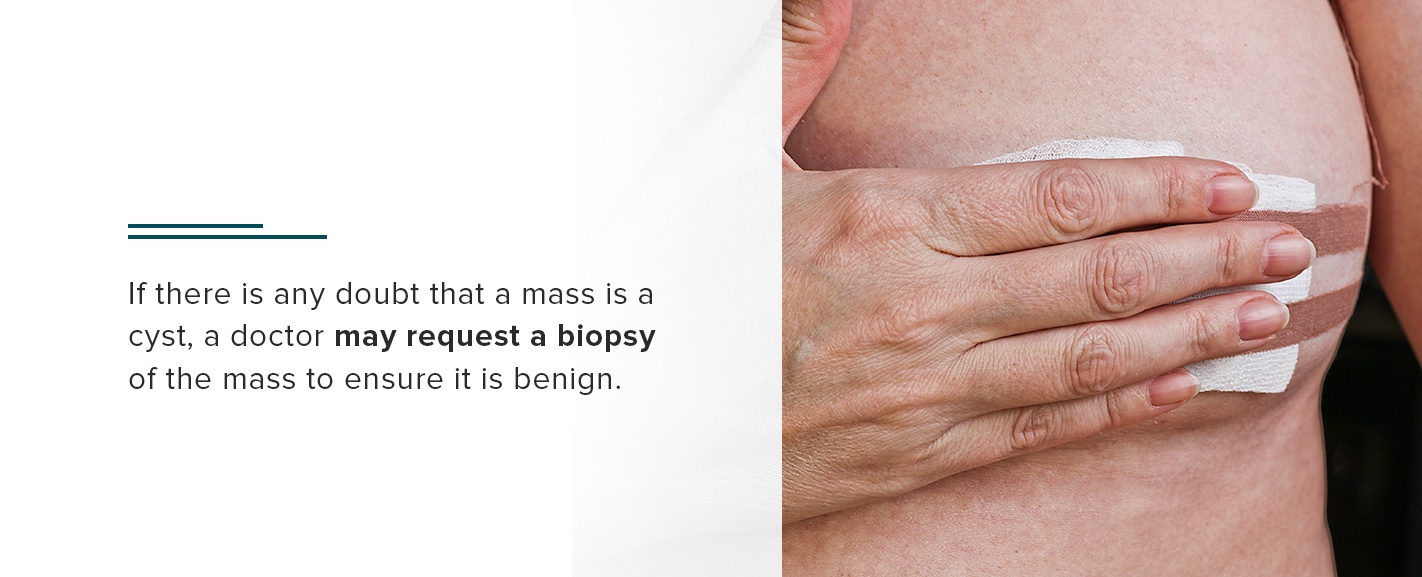 if there is any doubt that a mass is a cyst, a doctor may request a biopsy