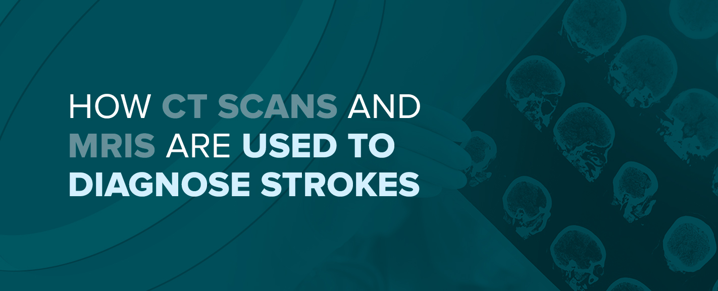 How CT Scans and MRIs Are Used to Diagnose Strokes