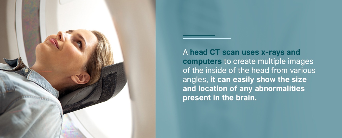 Head CT Scan