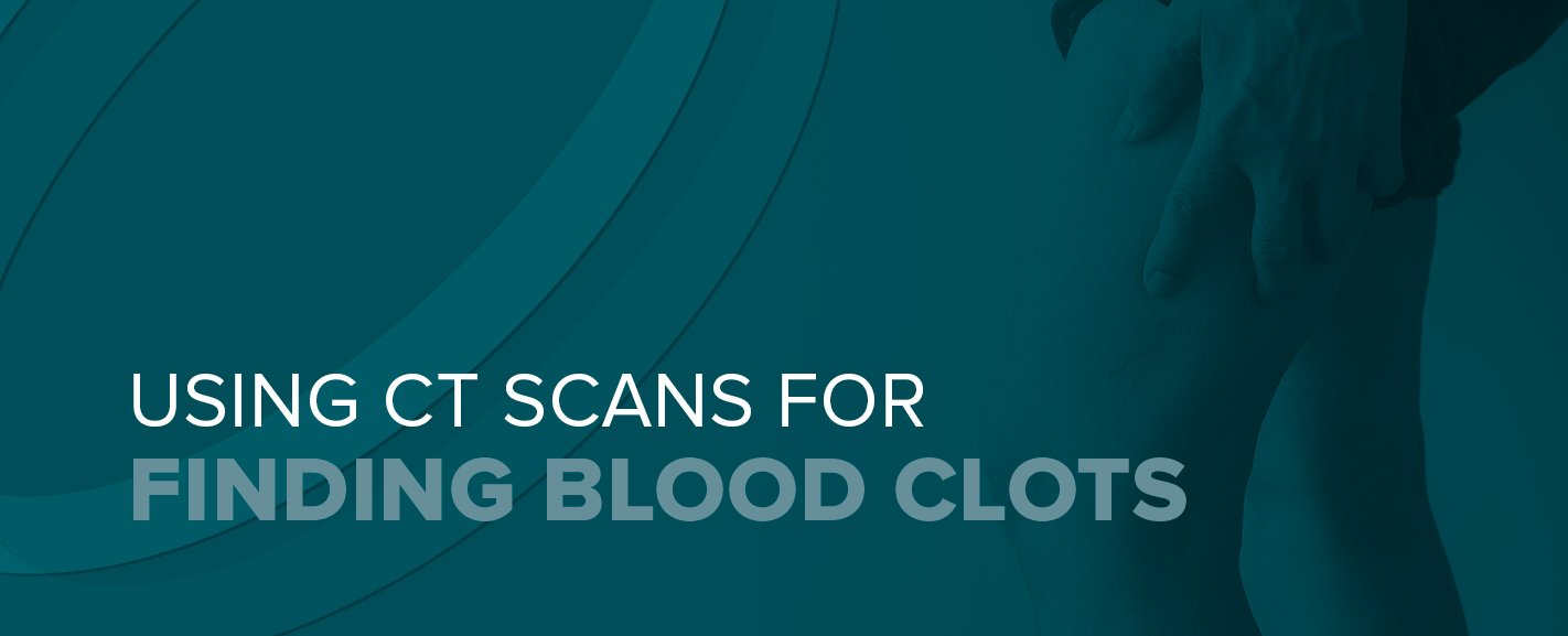 Using CT Scans for Finding Blood Clots