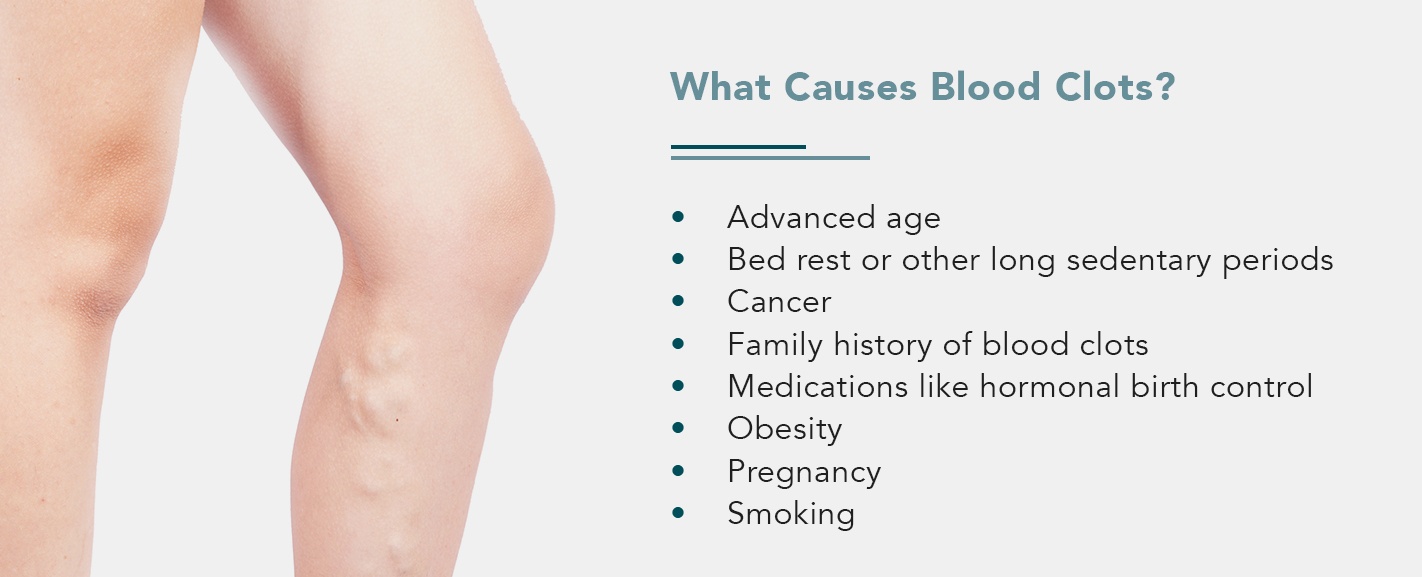 Blood Clots In Legs