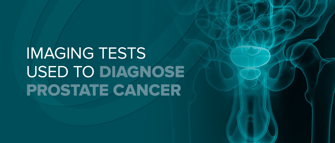 01 Imaging tests used to diagnose prostate cancer