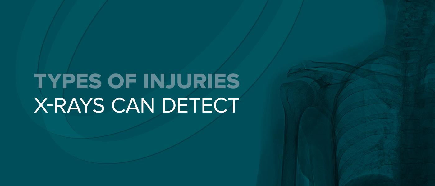 Types of Injuries X-Rays Can Detect