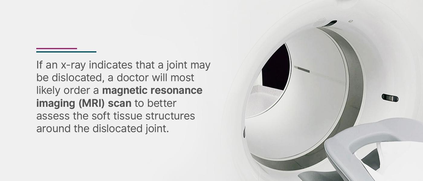 x-ray and mris for dislocated joints