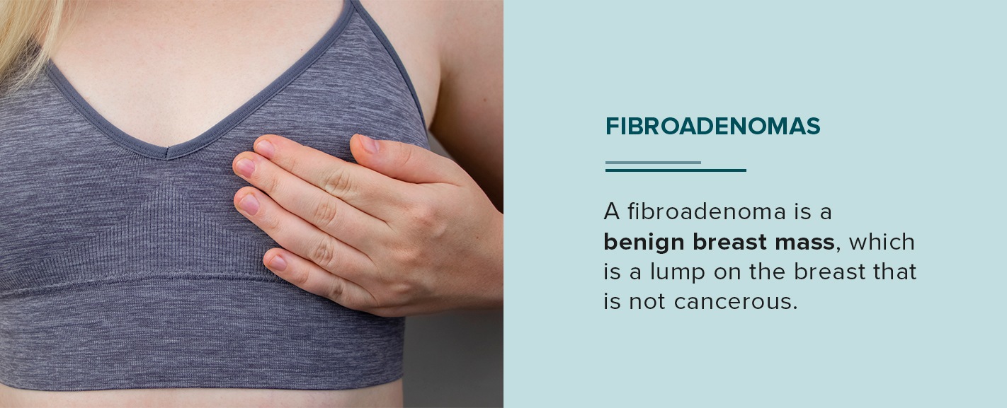 Fibroadenomas