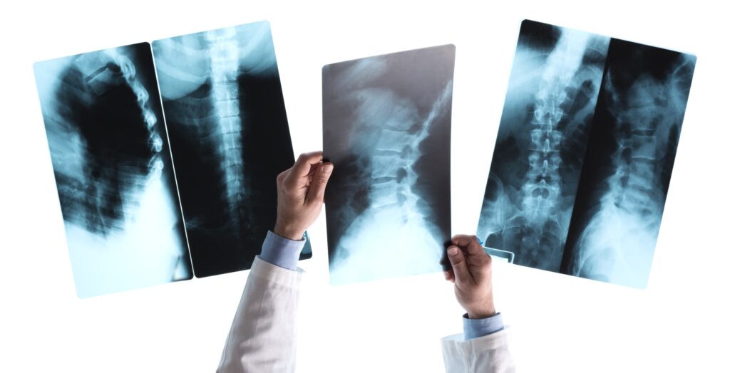 Types of Injuries X-rays Can Detect