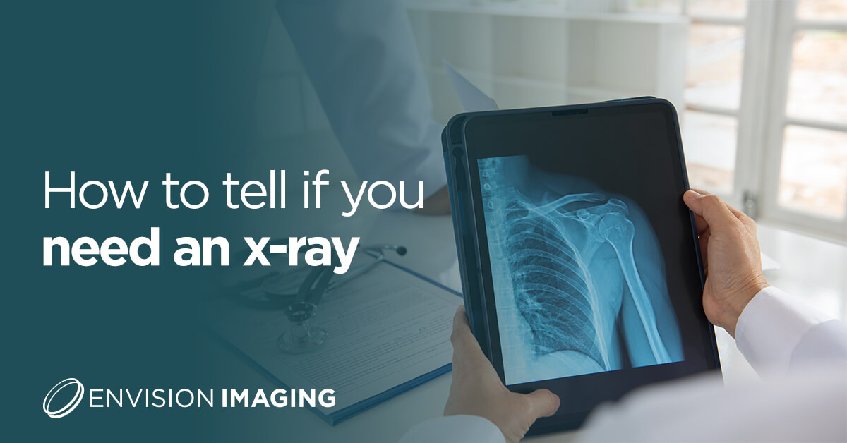 How To Tell If You Need An X Ray Envision Radiology