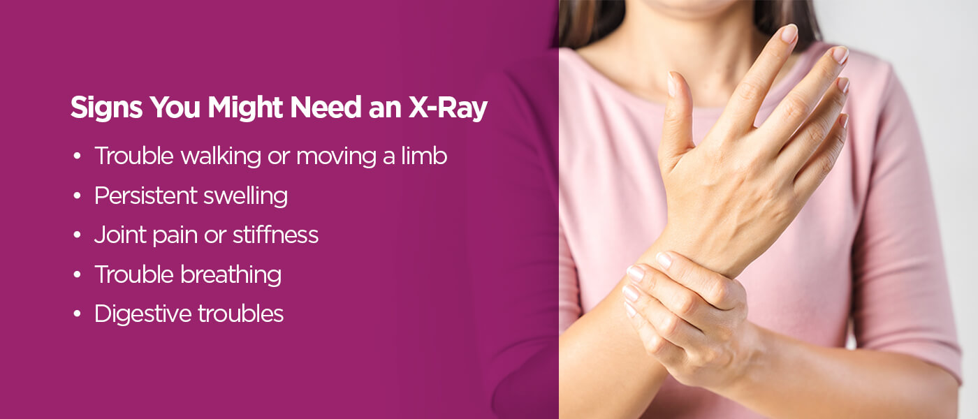 Signs you might need an x-ray [list]