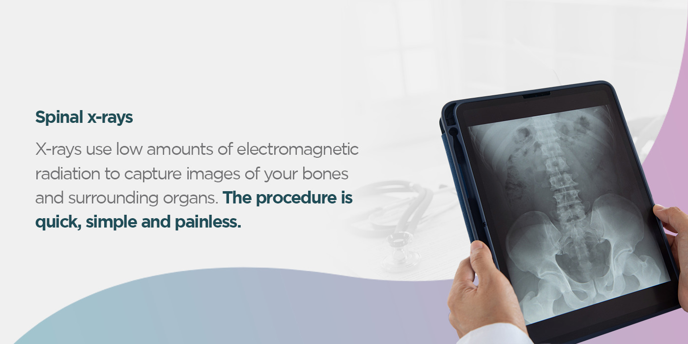 spinal -x-rays