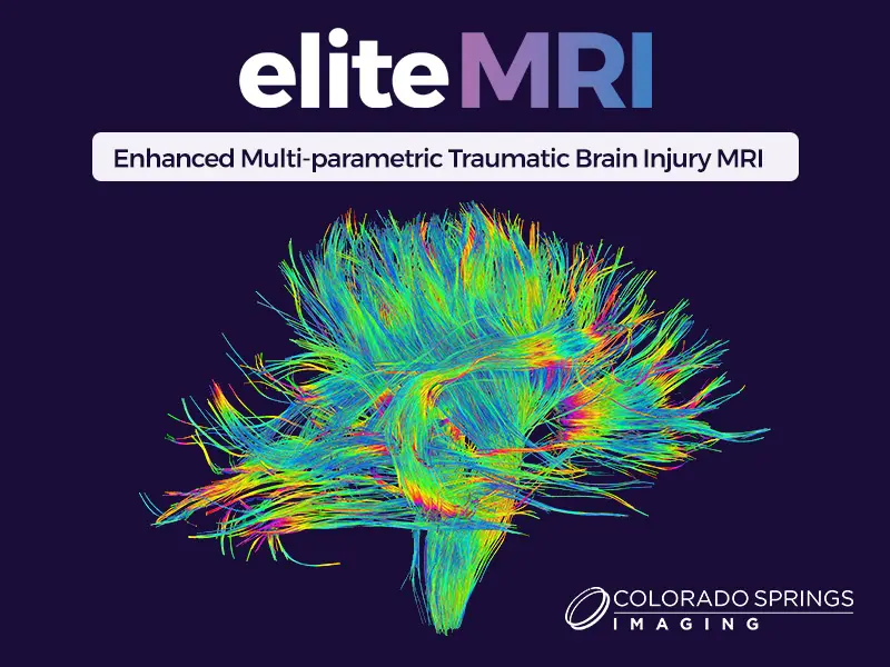 Diffusion Tensor Imaging in Traumatic Brain Injury