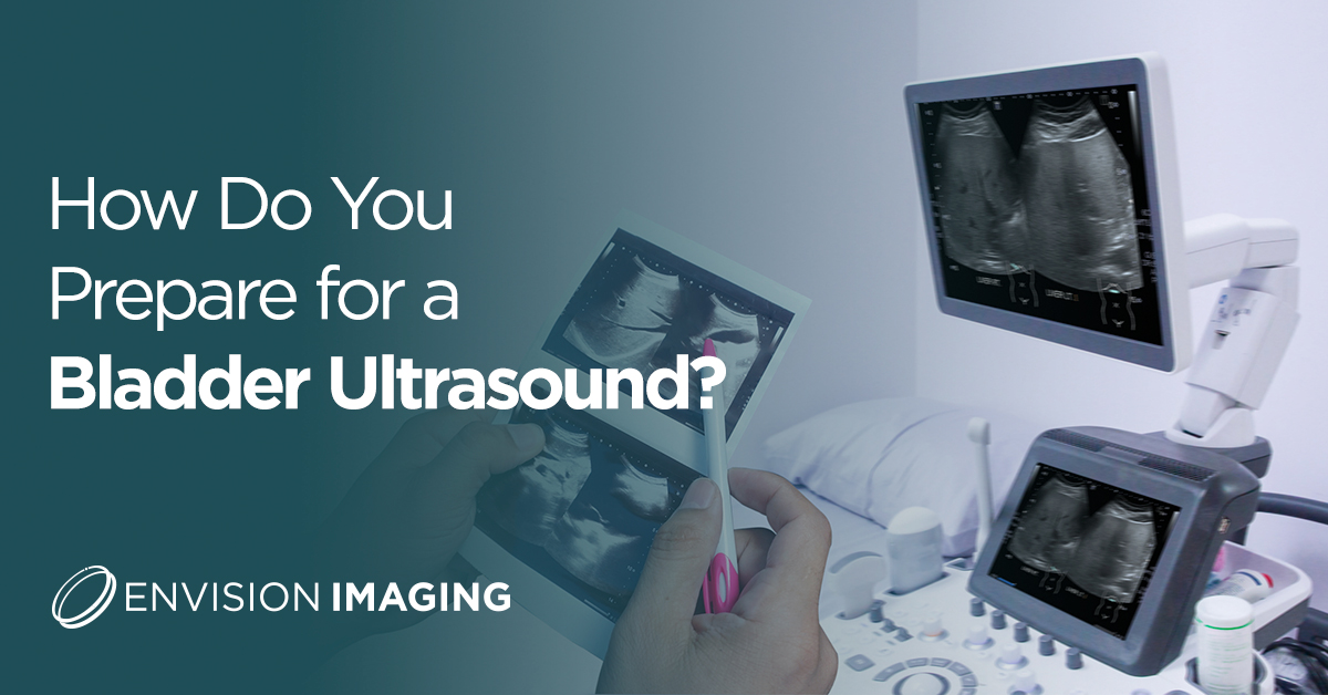 prepare for bladder ultrasound