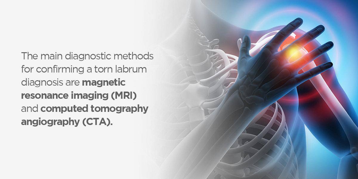 the main diagnostic method for confirming a torn labrum diagnosis are magnetic resonance imaging 