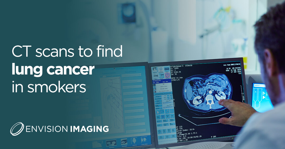 ct scans to find lung cancer