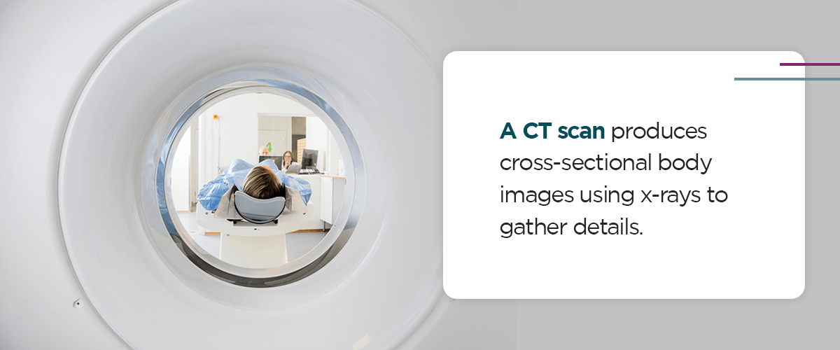 A-ct-scan