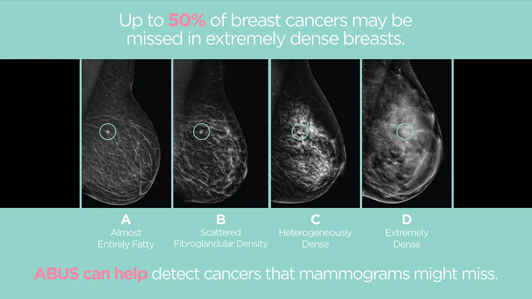 Image scans showing the difference in the different types scans for breast cancer